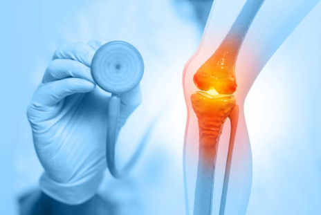 무릎에 물이 차는 증상 물이 찼을때 20