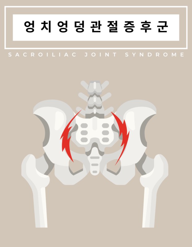 엉치엉덩관절