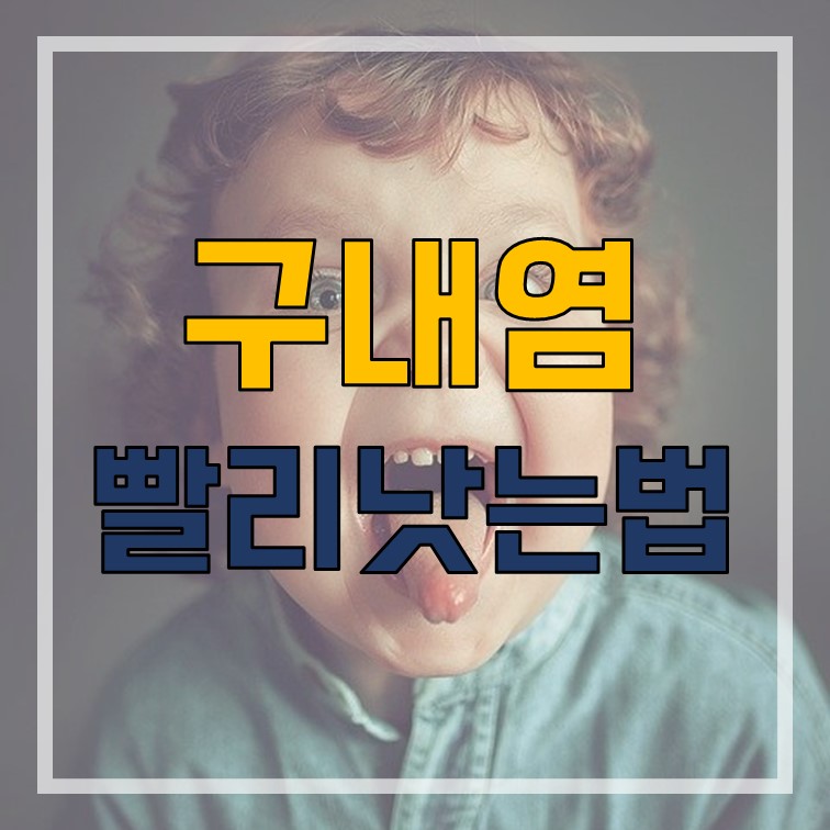  구내염 빨리 낫는법 알려드립니다.