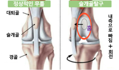 강아지 슬개골 조직도 그림