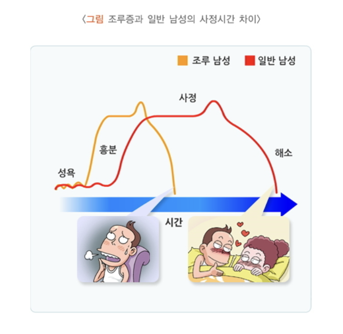 조루증과 일반 남성의 사정시간 차이