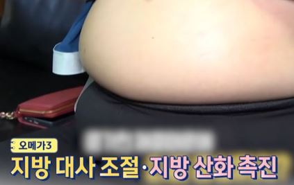 뱃살 사진