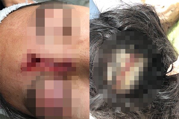  싱가포르 쇼트트랙 상비군 여성 선수, 부산 북구 덕천동 덕천역 쇠파이프 묻지마 폭행