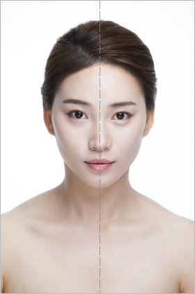  안면비대칭교정 TEST 해 보세요.