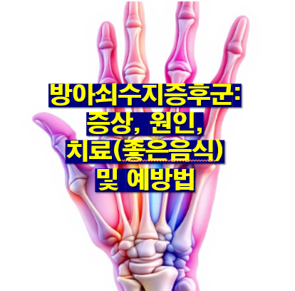 방아쇠수지증후군: 증상, 원인, 치료 및 예방법