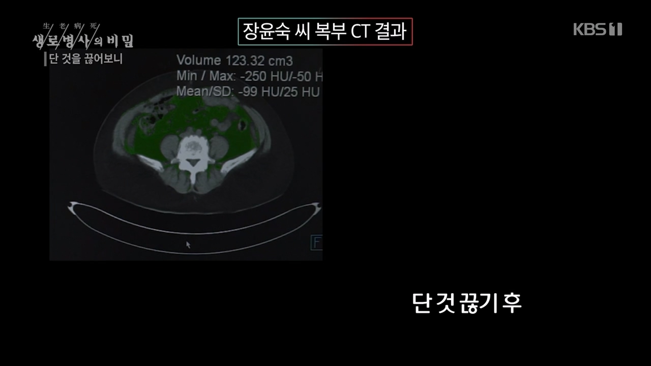 생로병사의 비밀.E877.230727p-NEXT.mp4_20230727_222748.884.jpg