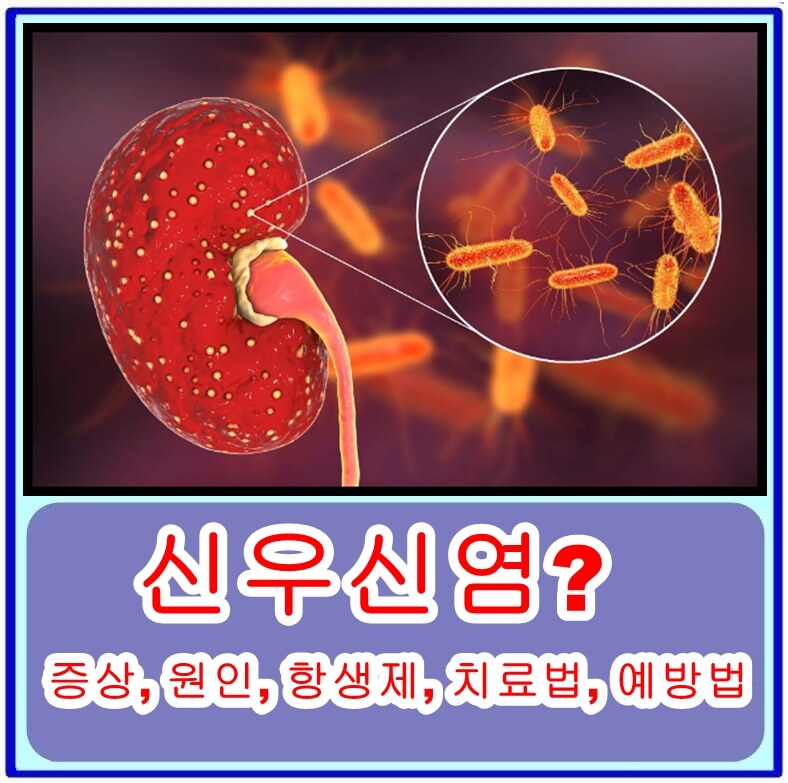 신우신염이란? 증상&#44; 원인&#44; 항생제&#44; 치료법&#44; 예방법