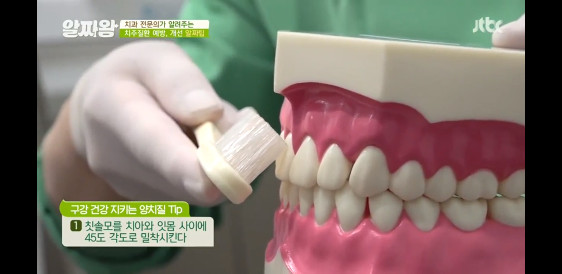  치주질환 예방을 위한 올바른 양치법/ 구강관리법(알짜왕)