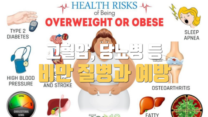 체중증가