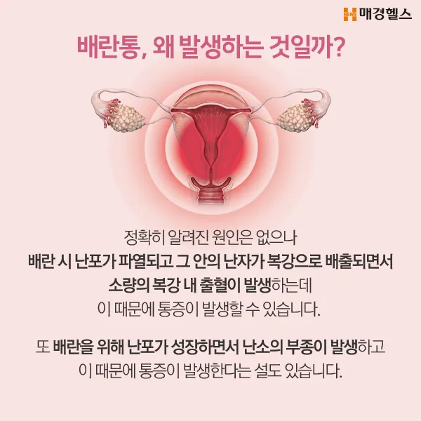 배란통 증상 및 시기 원인_6