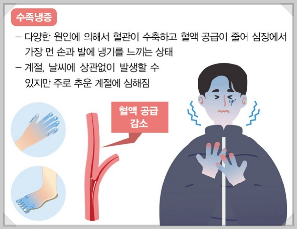 수족냉증의 원인과 치료방법 과 예방방법