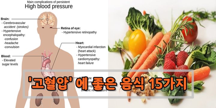 고혈압에 좋은 음식 썸네일