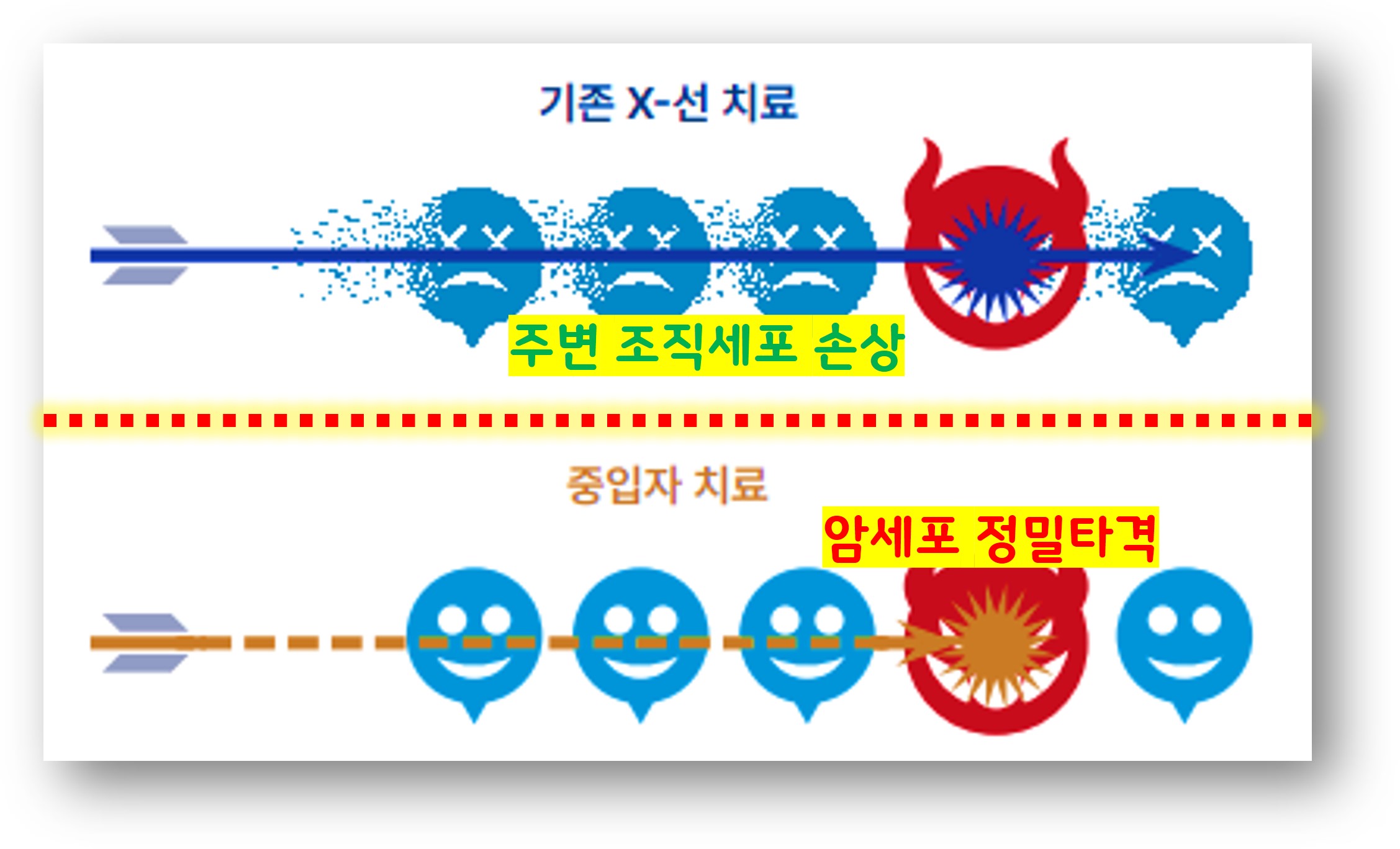 중입자치료 원리