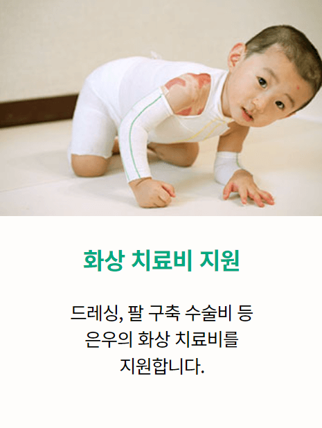 화상 치료비 지원