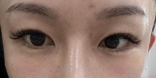 주름없이-팽팽한-눈가