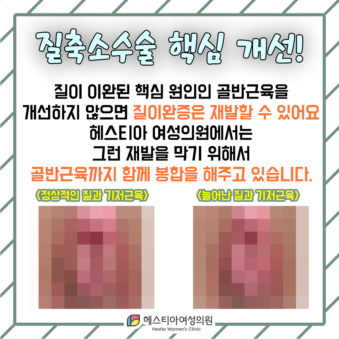 신사동산부인과 관계후 질방귀 질탄력 개선 질축소수술 원인 개선이 중요!