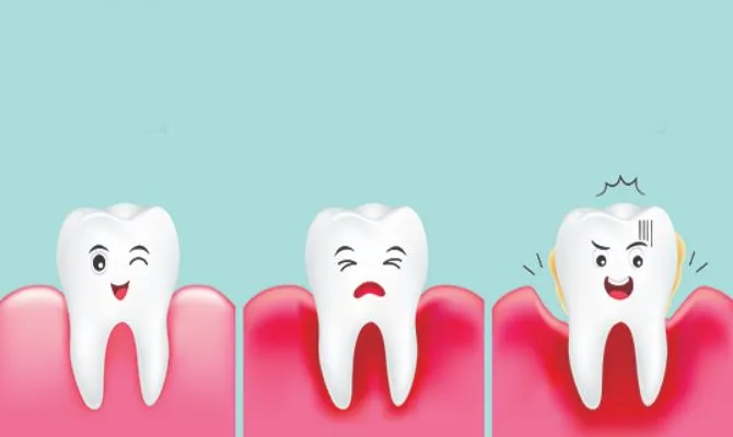 치주염 진행과정 치아와잇몸