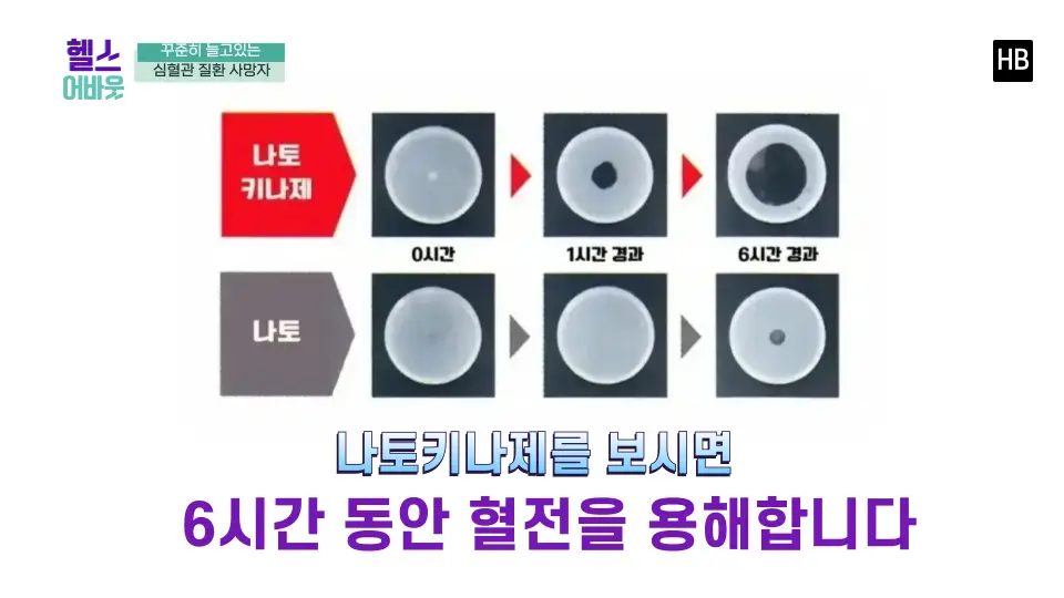 혈전용해제 나토키나제