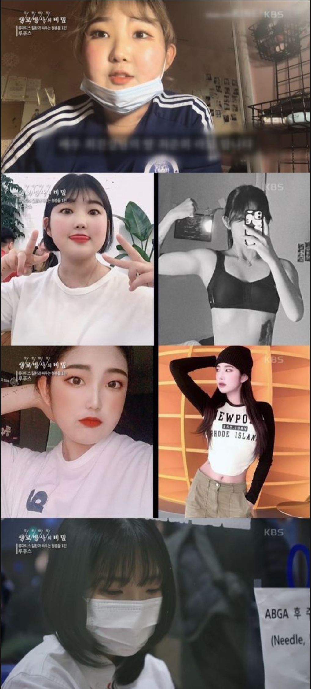  최진실 딸 최준희, 루푸스 재발 고백 "44kg 감량 후 좋아졌지만 루푸스 재발에 고통"