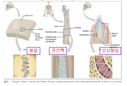 부동관절