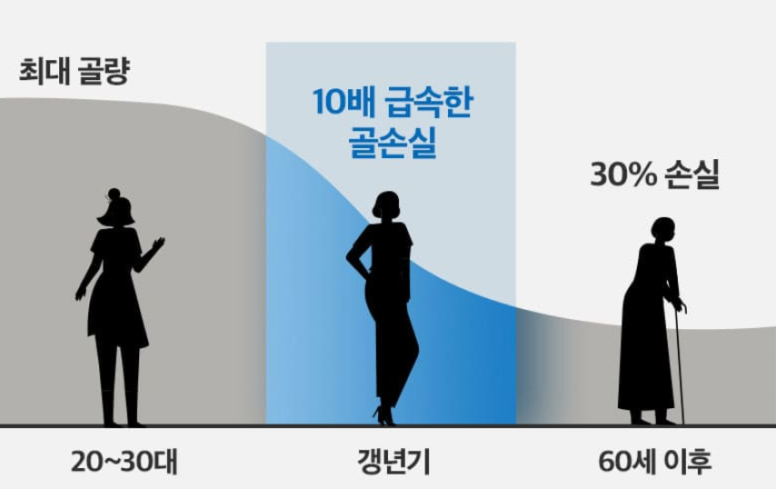 연령대별 골다공증 변화