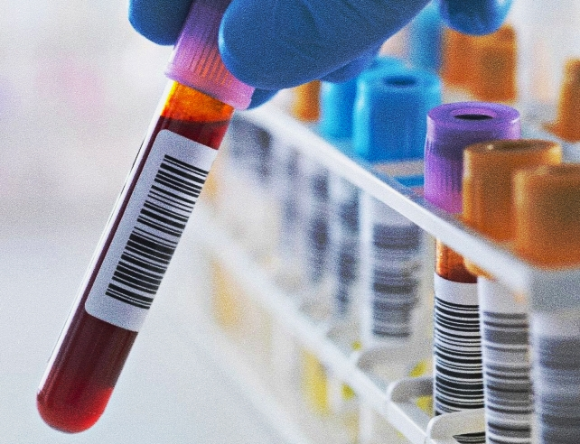 실리악병(셀리악병) 혈액 검사