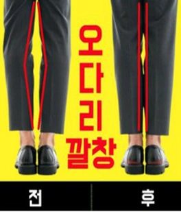 1+1 오다리깔창 키높이 깔창 팔자걸음 O다리&#44; 1개
