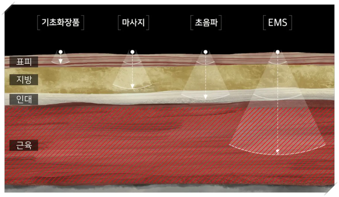 뷰앤디 앤모드 EMS모드