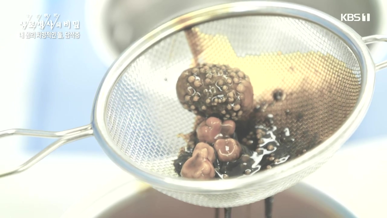 생로병사의 비밀.E886.231019p-NEXT.mp4_20231019_201734.566.jpg