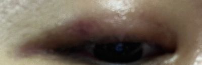 아이라인반영구 25