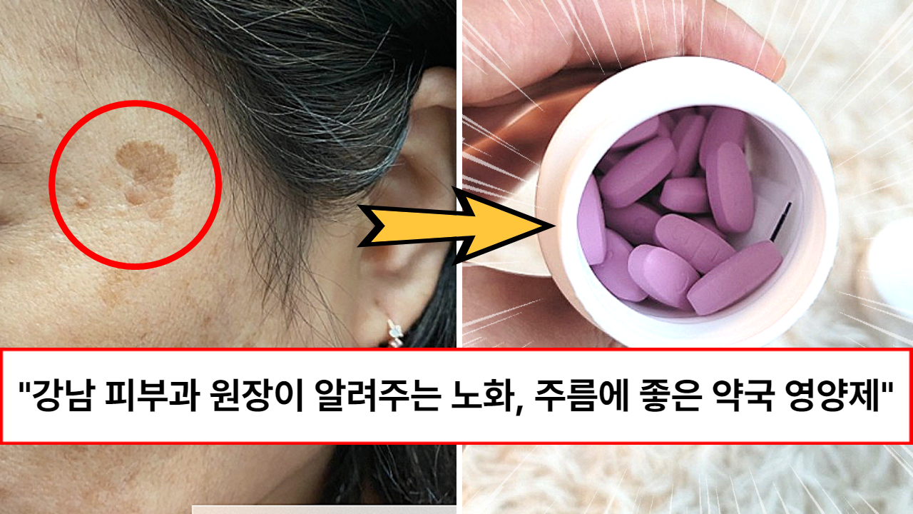 “이거 한 알이면 피부과 안가도 됩니다” 강남 피부과 쌤이 알려준 노화, 주름, 탄력, 피지조절에 좋은 약국 영양제