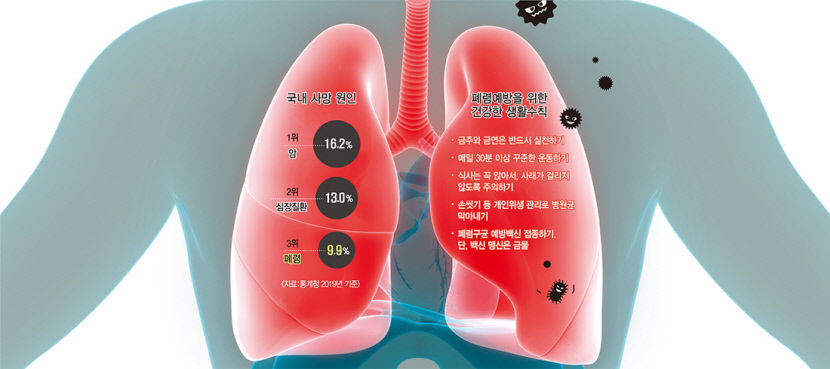 폐렴 사진