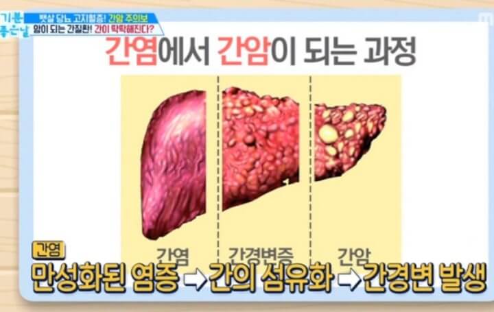 간에 좋은 음식 양배추