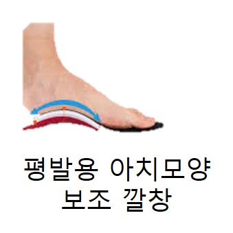 발 아치 모양의 깔창 사용