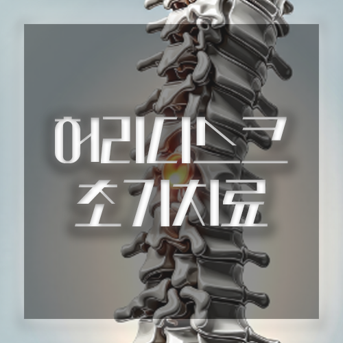 허리디스크 조기치료