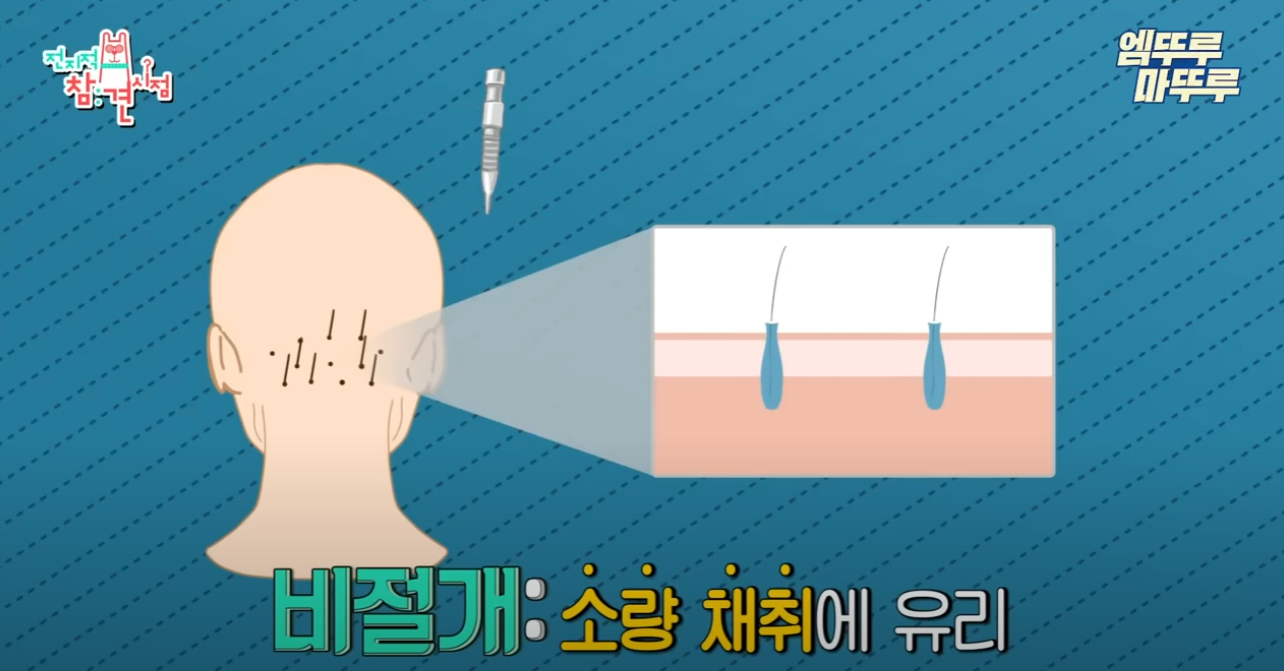 한상보 탈모샴푸