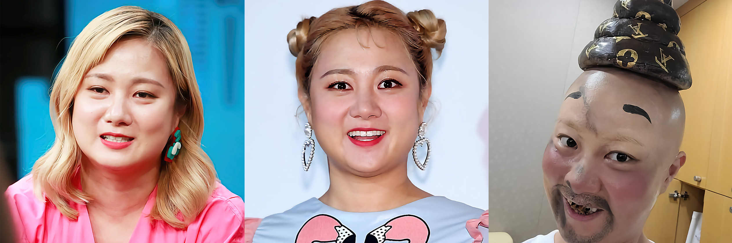  박나래 방송 활동 중단, 십자인대 파열