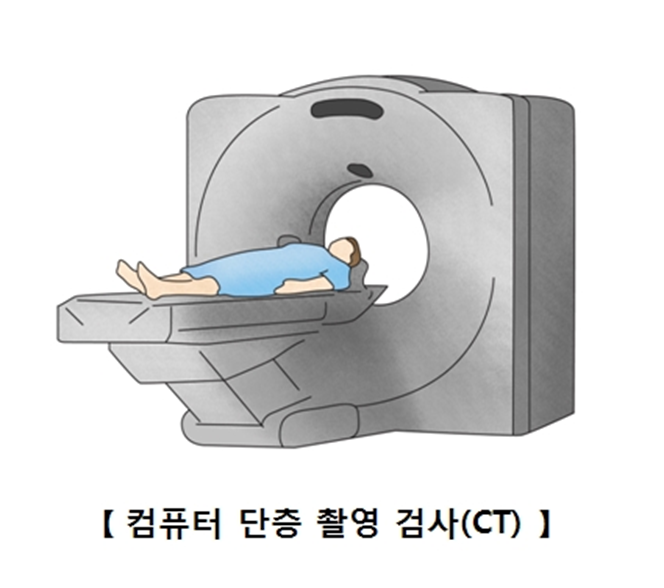 간세포성 암종(Hepatocellular carcinoma) 간암의 정의 증상 원인 치료 예방 방법 식사 요법 추천 음식 식단 극복