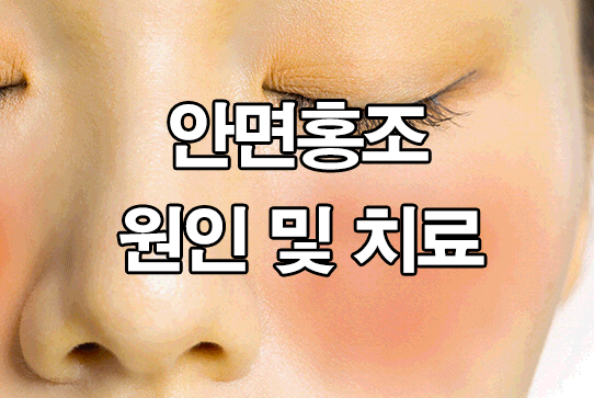  안면홍조 원인 : 치료법