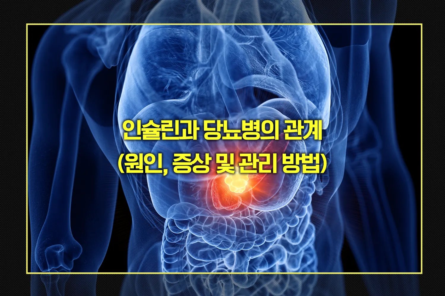 인슐린과 당뇨병의 관계