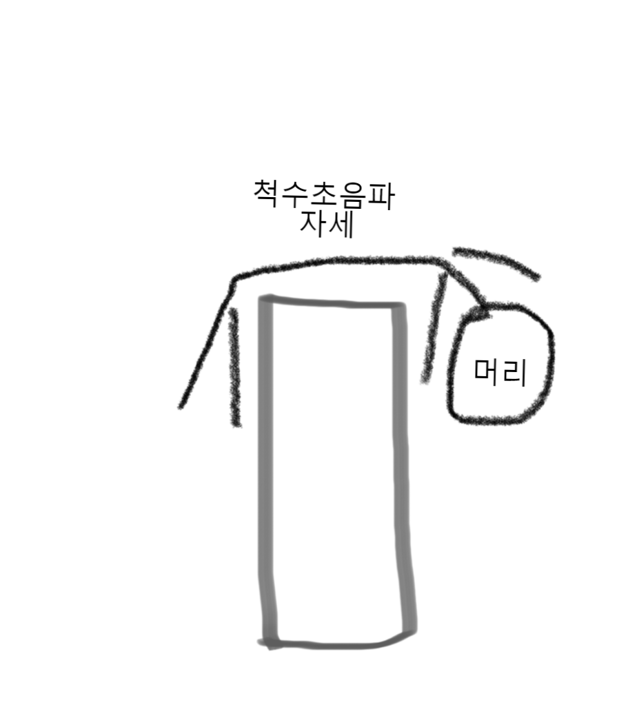  신생아 딤플로 아주대병원에서 척수 초음파검사 진행