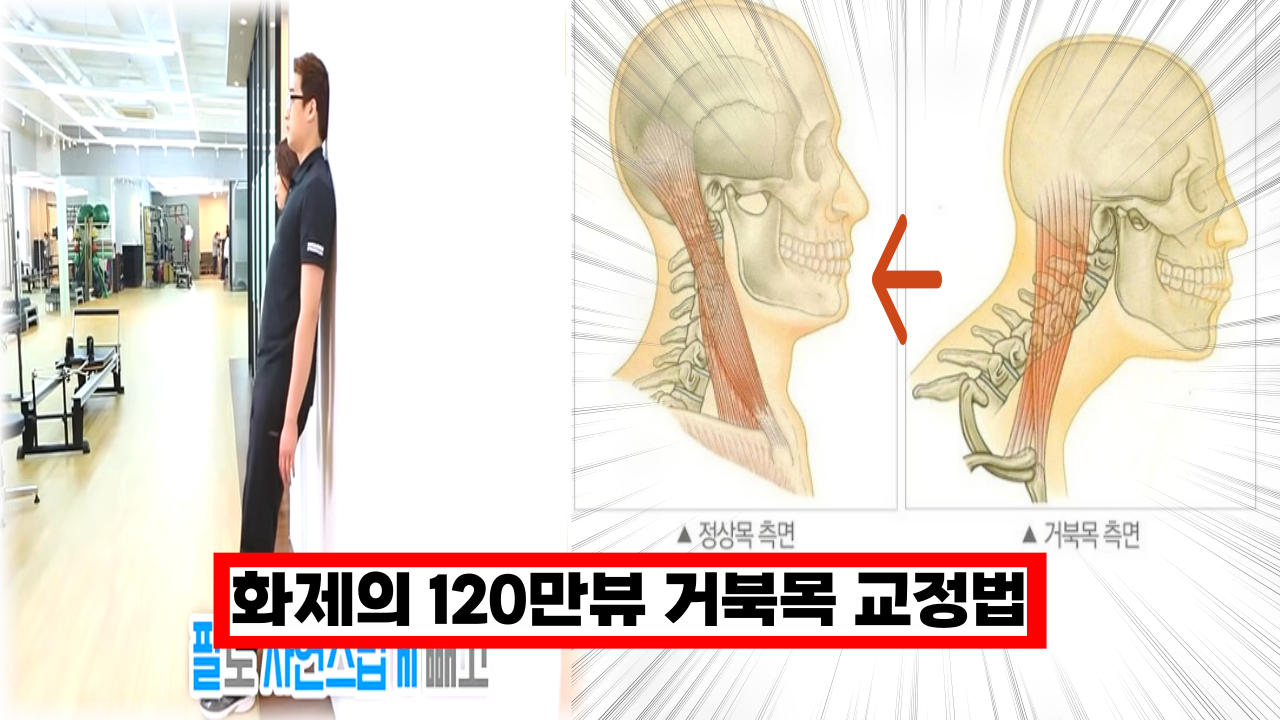  '화제의 120만뷰 거북목 교정법' 진짜 효과하나는 직빵임 ㅎㄷㄷ