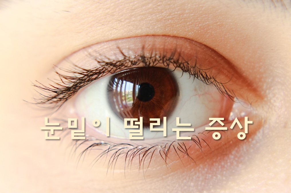  눈밑이 떨리는 증상과 눈꺼풀 떨림 현상