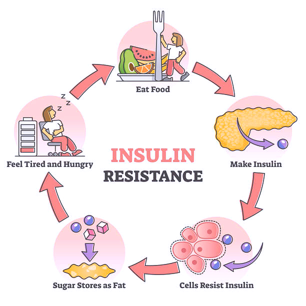 인슐린 내성