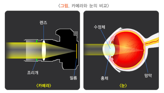 백내장 증상