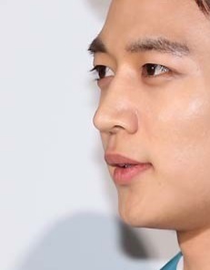  비염치료는 가능한가!