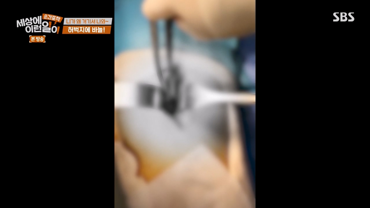 순간포착 세상에 이런일이.E1238.230723p-NEXT.mp4_20230724_205444.447.jpg