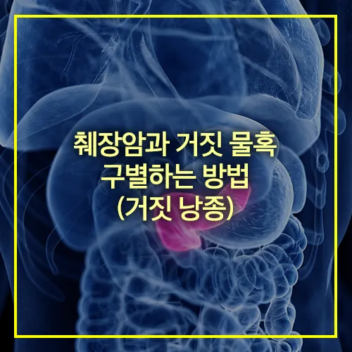 췌장암과 거짓 물혹 구별하는 방법 (거짓 낭종)