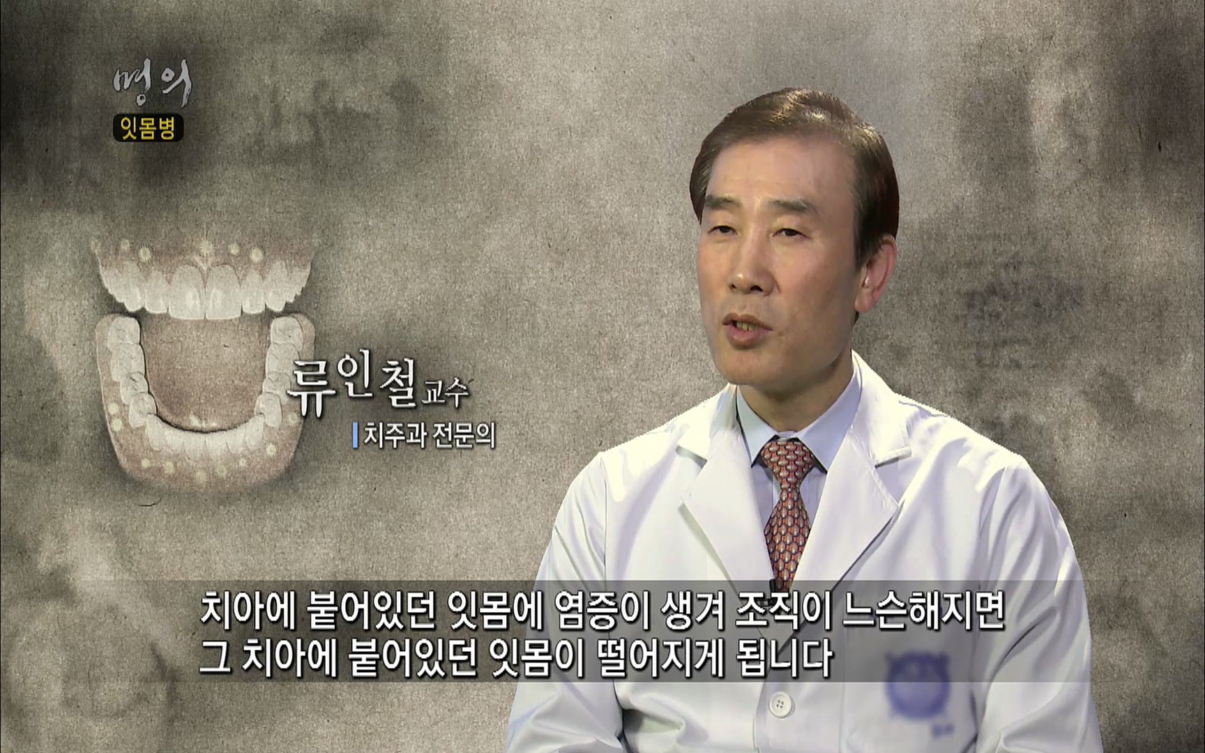 EBS 명의 헬스케어 - TV - 교육의 중심 EBS2015년 1월 16일 (금) 밤 9시 50분, EBS1.mp4_20220505_145328.262.jpg