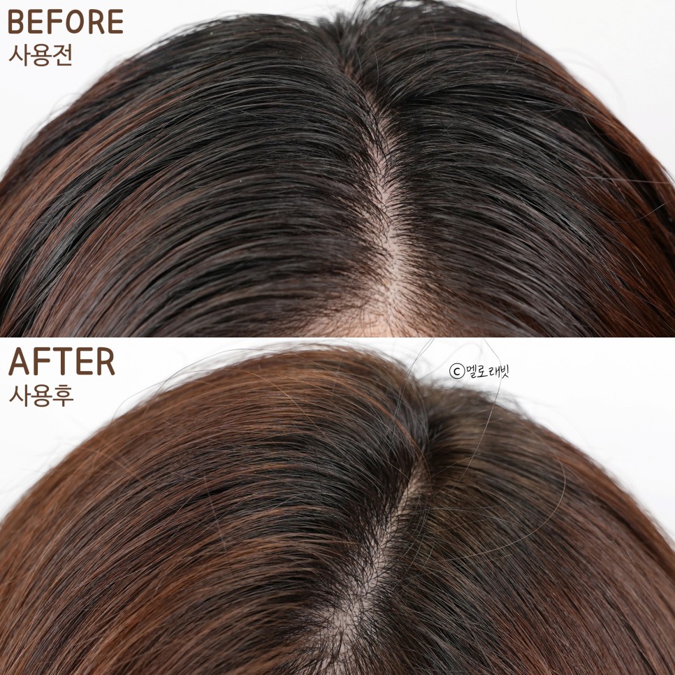 ts 탈모샴푸 이번엔 9